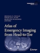 Atlas of Emergency Imaging from Head-to-Toe1st ed. 2022 Edición | اطلس تصویربرداری اضطراری از سر تا پا